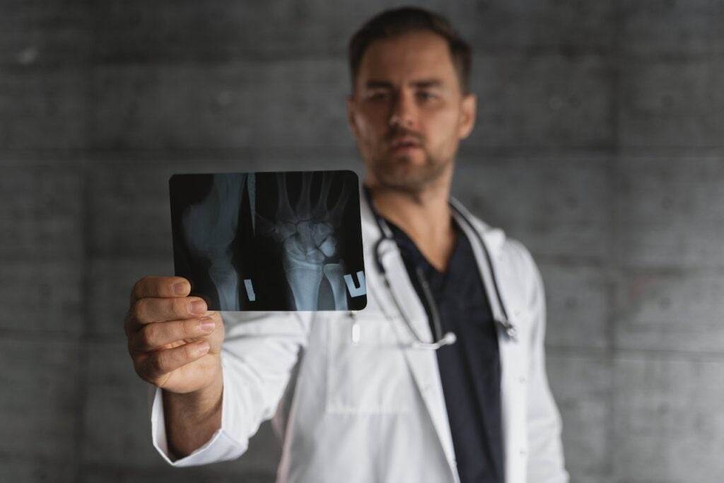 osteoporosis and fractures