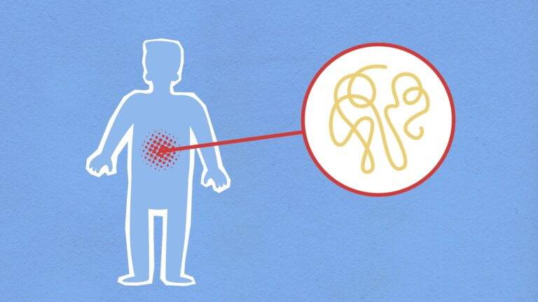body chronic inflammation during disease
